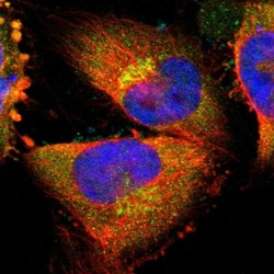 MANSC1 Antibody, Novus Biologicals 0.1mL; Unlabeled:Antibodies, Polyclonal